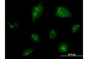 Immunofluorescence of monoclonal antibody to NCOA6 on HeLa cell. (NCOA6 抗体  (AA 1954-2063))