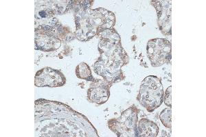 Immunohistochemistry of paraffin-embedded human placenta using PMEP antibody (6555) at dilution of 1:100 (40x lens). (PMEPA1 抗体  (AA 173-252))