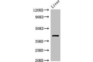 Western Blot Positive WB detected in: Rat liver tissue All lanes: TGDS antibody at 3 μg/mL Secondary Goat polyclonal to rabbit IgG at 1/50000 dilution Predicted band size: 41 kDa Observed band size: 41 kDa (TGDS 抗体  (AA 143-305))