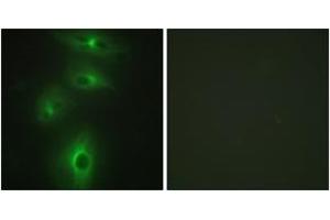 Immunofluorescence analysis of HeLa cells, using TMPRSS3 Antibody. (TMPRSS3 抗体  (AA 405-454))