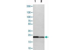 Western blot analysis of cell lysates with SPCS2 polyclonal antibody  at 1:250-1:500 dilution. (SPCS2 抗体)