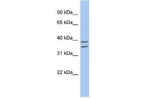 WB Suggested Anti-ZADH2 Antibody Titration: 0. (ZADH2 抗体  (N-Term))