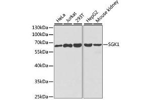 Western blot analysis of extracts of various cell lines, using SGK1 antibody. (SGK1 抗体  (AA 172-431))