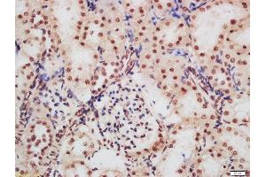 Formalin-fixed and paraffin embedded rat kidney labeled with Rabbit Anti-CDKN1A (Ser130) Polyclonal Antibody, Unconjugated  at 1:200 followed by conjugation to the secondary antibody and DAB staining (p21 抗体  (pSer130))
