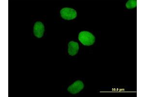 Immunofluorescence of purified MaxPab antibody to XRCC4 on HeLa cell. (XRCC4 抗体  (AA 1-336))