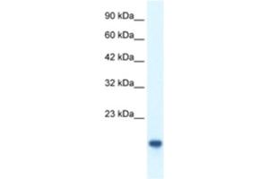 Western Blotting (WB) image for anti-C-Myc Binding Protein (MYCBP) antibody (ABIN2460299)