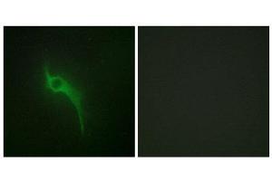 Immunofluorescence (IF) image for anti-Collagen, Type V, alpha 1 (COL5A1) (Internal Region) antibody (ABIN1850288) (COL5A1 抗体  (Internal Region))