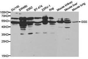 Western Blotting (WB) image for anti-Glutathione Synthetase (GSS) antibody (ABIN1872909) (Glutathione Synthetase 抗体)