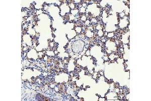 IHC analysis of VE Cadherin using anti-VE Cadherin antibody (ABIN5692987). (Cadherin 5 抗体  (AA 46-285))