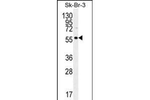 LOC129293 Antibody (C-term) (ABIN655687 and ABIN2845146) western blot analysis in SK-BR-3 cell line lysates (35 μg/lane). (TRABD2A 抗体  (C-Term))
