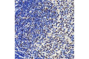 Immunohistochemistry of paraffin-embedded rat spleen using SP1 antibody (ABIN7270505) at dilution of 1:100 (40x lens). (SP1 抗体)