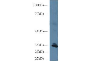 Western Blot; Sample: Human Liver lysate; Primary Ab: 1µg/ml Rabbit Anti-Human PPIE Antibody Second Ab: 0. (PPIE 抗体  (AA 41-264))