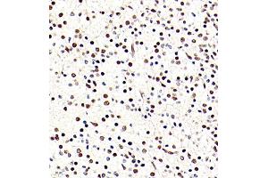 Immunohistochemistry of paraffin embedded rat embryonic rat using BRN3A (ABIN7075163) at dilution of 1:700 (400x lens) (POU4F1 抗体)
