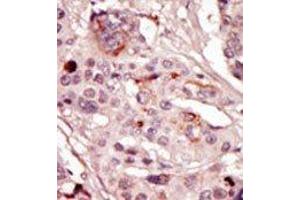 Image no. 2 for anti-Src-Related Kinase Lacking C-Terminal Regulatory Tyrosine and N-Terminal Myristylation Sites (SRMS) (N-Term) antibody (ABIN359993)