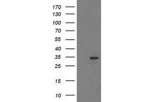 Western Blotting (WB) image for anti-Haloacid Dehalogenase-Like Hydrolase Domain Containing 2 (HDHD2) antibody (ABIN1498628) (HDHD2 抗体)