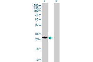 Western Blot analysis of ASB6 expression in transfected 293T cell line by ASB6 MaxPab polyclonal antibody. (ASB6 抗体  (AA 1-197))