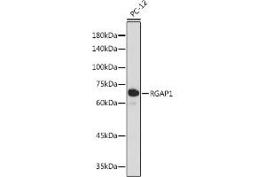 Western blot analysis of extracts of PC-12 cells, using RG antibody (ABIN7269819) at 1:1000 dilution. (RACGAP1 抗体)
