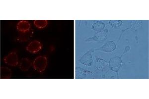 Immunocytochemistry (ICC) image for anti-Transient Receptor Potential Cation Channel, Subfamily V, Member 2 (TRPV2) (AA 413-428), (Extracellular) antibody (ABIN7043845)