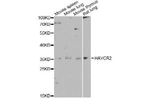 Western blot analysis of extracts of various cell lines, using HAVCR2 antibody. (TIM3 抗体  (AA 22-202))