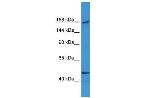 Western Blot showing BTBD12 antibody used at a concentration of 1-2 ug/ml to detect its target protein. (BTBD12 抗体  (N-Term))