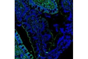 IF analysis of Villin using anti-Villin antibody (ABIN3042343).
