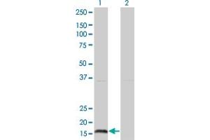 Western Blot analysis of IFNA2 expression in transfected 293T cell line by IFNA2 monoclonal antibody (M37), clone 2D6. (IFNA2 抗体  (AA 24-188))
