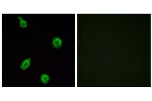 Immunofluorescence analysis of HUVEC cells, using HTR5B antibody.