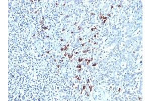 Formalin-fixed, paraffin-embedded human Tonsil stained with Kappa Light Chain Mouse Monoclonal Antibody (KLC264). (IGKC 抗体)