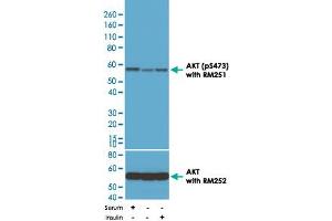 Western Blot (Cell lysate) analysis of 293 cell with AKT (phospho S473) monoclonal antibody, clone RM251 . (AKT1 抗体  (pSer473))
