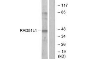 Western blot analysis of extracts from COS7 cells, using RAD51L1 Antibody. (RAD51 Homolog B 抗体  (AA 201-250))