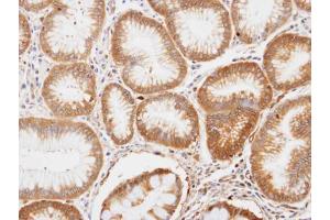 IHC-P Image Immunohistochemical analysis of paraffin-embedded human gastric tissue, using ENO1, antibody at 1:100 dilution. (ENO1 抗体)