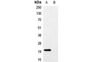 Western blot analysis of Anti-Myc-tag Antibody against HEK293T cells transfected with vector overexpressing Myc tag (A) and untransfected (B).