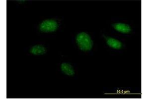 Immunofluorescence of purified MaxPab antibody to ARL3 on HeLa cell. (ARL3 抗体  (AA 1-182))