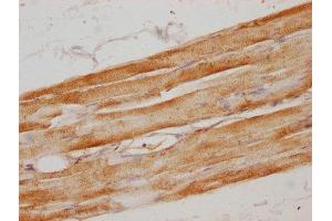 IHC image of ABIN7160584 diluted at 1:100 and staining in paraffin-embedded human skeletal muscle tissue performed on a Leica BondTM system. (MYH6 抗体  (AA 894-1132))
