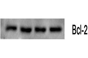 Western Blot (WB) analysis: Please contact us for more details. (Bcl-2 抗体)
