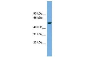 TMPRSS4 antibody used at 0. (TMPRSS4 抗体  (N-Term))
