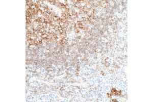 Immunohistochemistry (IHC) image for anti-CD40 (CD40) (AA 227-277) antibody (ABIN7454023) (Recombinant CD40 抗体  (AA 227-277))