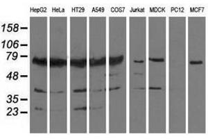 Image no. 2 for anti-Pseudouridylate Synthase 7 Homolog (PUS7) antibody (ABIN1500515) (PUS7 抗体)