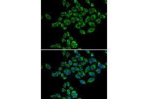 Immunofluorescence analysis of HeLa cells using SRPK1 antibody. (SRPK1 抗体)