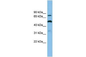 WB Suggested Anti-SLC26A1 Antibody Titration: 0. (SLC26A1 抗体  (Middle Region))