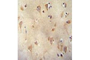 Immunohistochemistry analysis in formalin fixed and paraffin embedded human brain tissue reacted with  LRRC40 Antibody (C-term) followed which was peroxidase conjugated to the secondary antibody and followed by  DAB staining. (LRRC40 抗体  (C-Term))