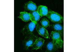 IF analysis of YARS1 using anti-YARS1 antibody (ABIN7601158). (YARS1 (AA 294-523) 抗体)