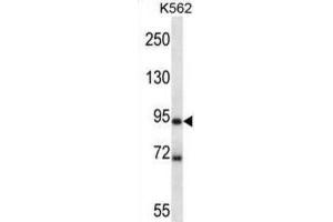 Western Blotting (WB) image for anti-MAP/microtubule Affinity-Regulating Kinase 1 (MARK1) antibody (ABIN2997857) (MARK1 抗体)