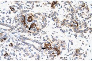 Human Pancreas (MEK2 抗体  (C-Term))