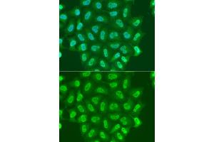 Immunofluorescence analysis of A549 cell using POLR2A antibody. (POLR2A/RPB1 抗体)