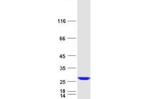 Western Blotting (WB) image for RAB38, Member RAS Oncogene Family (RAB38) protein (Myc-DYKDDDDK Tag) (ABIN2730345)