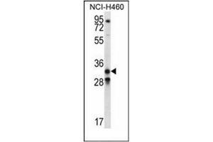 Western blot analysis of GDF15 Antibody (N-term) in NCI-H460 cell line lysates (35ug/lane). (GDF15 抗体  (N-Term))