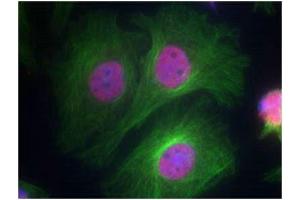 Immunofluorescence staining of methanol-fixed Hela cells using p53 (Phospho-Ser15) Antibody. (p53 抗体  (pSer15))