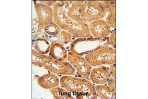 COQ9 Antibody immunohistochemistry analysis in formalin fixed and paraffin embedded human lung tissue followed by peroxidase conjugation of the secondary antibody and DAB staining. (COQ9 抗体  (AA 156-184))