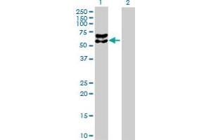 Western Blot analysis of BACE1 expression in transfected 293T cell line by BACE1 MaxPab polyclonal antibody. (BACE1 抗体  (AA 1-476))